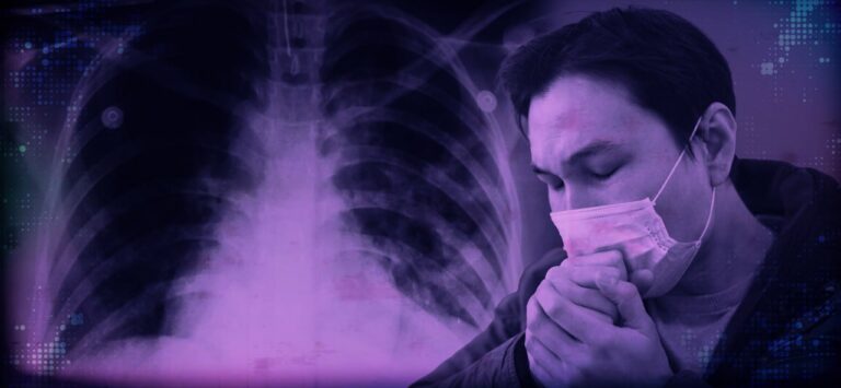 Key Findings on Nationwide TB Awareness and Perceptions Among Filipinos